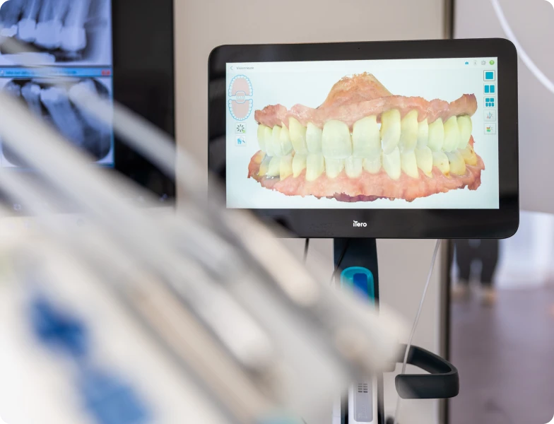 examen dentaire docteurs simonis strasbourg examen dentaire docteurs simonis strasbourg Pose d'un implant dentaire Pose d'un implant dentaire | Dr Simonis | Dentiste Strasbourg