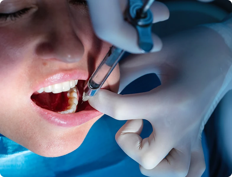 Dentiste injectant un anesthésiant local