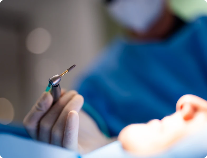 pose implant dentaire docteur simonis strasbourg pose implant dentaire docteur simonis strasbourg Pose d'un implant dentaire Pose d'un implant dentaire | Dr Simonis | Dentiste Strasbourg