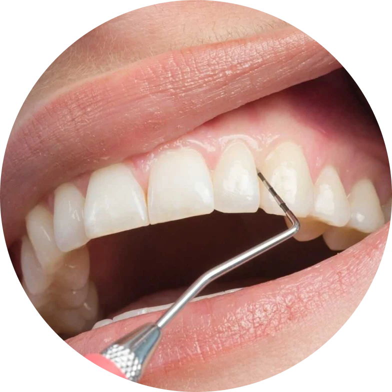 Soins des gencives